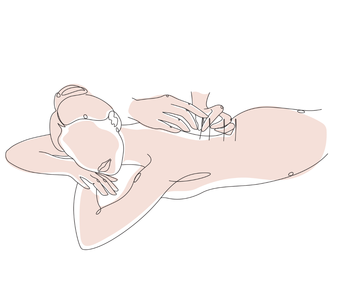Acupuncture for Fertility